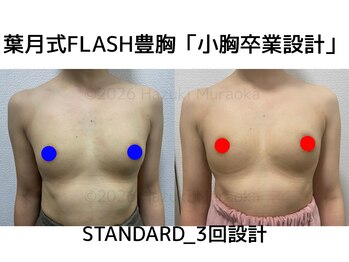 セブンシーズ 上野店(Seven Seas)/バストアップ/豊胸/東京都/上野