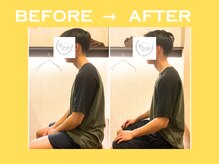 こころ整骨院/20代男性のビフォーアフター