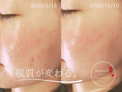 モエラビューティーサロン(Moela beauty salon)の写真