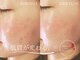 モエラビューティーサロン(Moela beauty salon)の写真