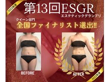 ミックスアップ 練馬店(Mix up)/2023年全国ファイナリスト選出