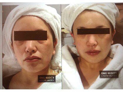 ラ ペジヴル(la Paisible)の写真