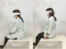 ナオル整体 国分寺院(NAORU整体)/30代女性【姿勢改善】