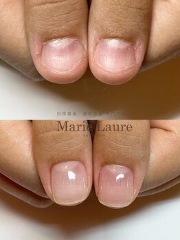 マリーロール 淀屋橋本店(Marie Laure)/自爪育成/深爪矯正/ネイルケア