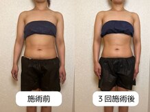 優子さんの美容矯正サロン/痩身効果/全体写真BA