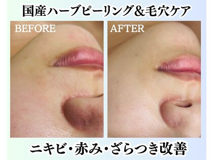 ビューティーザイオン(Beauty zion)の写真