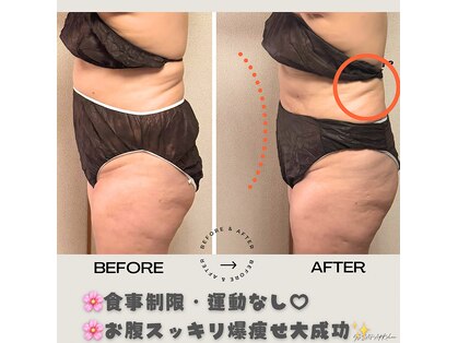 ヨサパーク シアー(YOSA PARK sheer)の写真