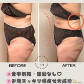 ヨサパーク シアー(YOSA PARK sheer)