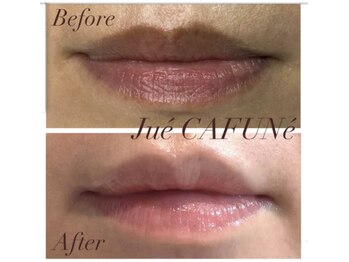 ジュエカフネ 広尾(JueCAFUNe)/ルメラ3ヶ月後。ブログ詳細みて