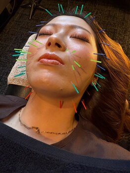 メディカルジャパン 吉祥寺/美容鍼灸