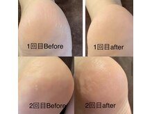 スターリィ スカイ(Starry☆Sky)/【かかと】ワックスパック