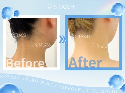 ストラッシュ 新潟店(STLASSH)の写真