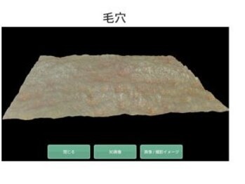 美容の宝石箱/【肌診断】3D診断/6つ測定項目