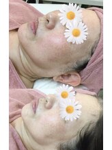 スマイルデイズ(Smiledays)/くすみケア　50代前半