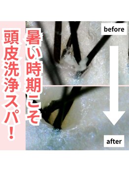 サロンドミヤシタ(SALON DE MIYASHITA)/頭皮のかゆみ、臭いに効果的