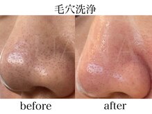 ルアナ(LUANA)/毛穴洗浄