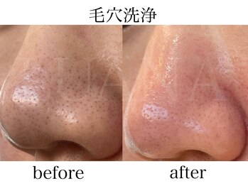 ルアナ(LUANA)/毛穴洗浄