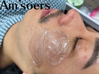 エムソエル(Am'soers)の写真/【毛穴洗浄・顔脱毛】気になる皮脂詰まりや黒ずみを徹底除去！顔脱毛で気になる産毛もスッキリOFF！