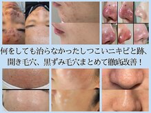 ハオン(HAON)
