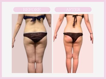 スリムライン 八戸店(The Slim Line)/before→after