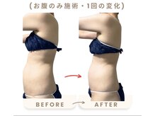 ネオボディ(Neo Body)/お試しで検証してみました！