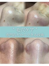 シェリール 大宮(cherir)&nbsp;毛穴ケア 拘りの技術