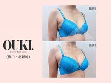 オウキ 梅田北新地(OUKI.)/バストアップ結果写真