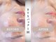モルティー 広島店(Molti)の写真/【小顔専門サロン】驚きのBeforeAfter！小顔矯正で一気にリフトアップ◎持続する小顔を目指せるサロンです