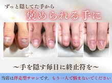 ブルームーンネイルズ(BLOOMOON.nails)