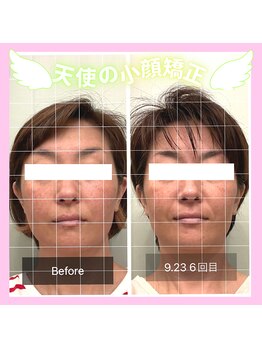 シエロ アスール(Cielo azul)/続けるごとに変化・継続