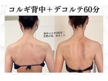 メノウ(Meknow)の雰囲気（冷え浮腫み、老廃物をしっかり圧をかけて流す温活コルギ。）