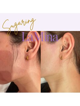 ラ ミーナ(LaMina)/もみあげシュガーリング