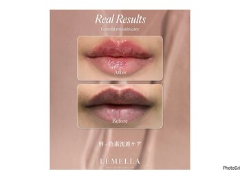 ダチュラ(Da'Chura)