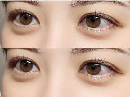 ヨーク トゥルペ(yorke tulpe)の写真