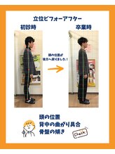 鈴鹿やまもと整体院/姿勢矯正ビフォーアフター
