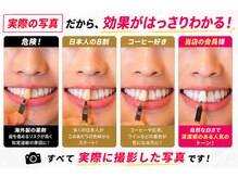 ホワイトサロン