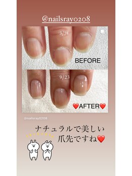 ネイルズレイ(Nails Ray)/