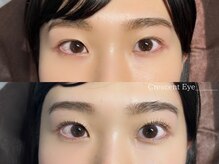 クレセント アイアンドネイル 表参道(Crescent Eye&Nail)/上下次世代まつげパーマ