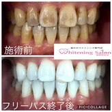 ホワイトニングサロン 福岡博多店