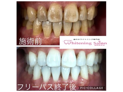 ホワイトニングサロン 福岡博多店の写真