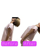 鍼の魔法 恵比寿院/腰の痛み　施術回数:1回