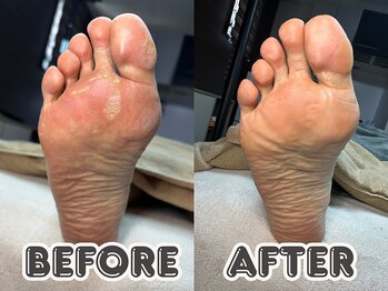 ポドロ ウィズ ニコルル 大阪天満店(PoDoLo with Nicolulu)/【たこ・角質】フットケア大阪