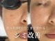 アールビューティー(R Beauty)の写真