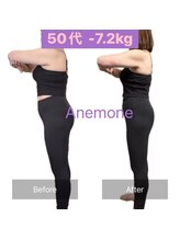 アネモネ/ダイエット/痩身/耳つぼ/腸活