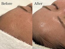 トム(Thom)/鼻の黒ずみは産毛が原因かも？