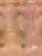 ストーリー(STORY)/眉毛と艶肌ワックス専門店