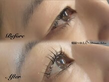 癒縁(ゆえん)/瞳に光が入る【艶瞳リフト】