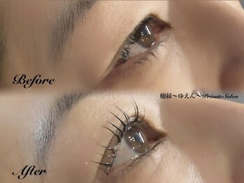 癒縁(ゆえん)/瞳に光が入る【艶瞳リフト】