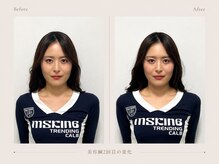 *美容鍼専門店 HARISTA*【小顔矯正/LED美容/整体】の雰囲気（1回で変化を実感したとの声多数！初回3850円♪）