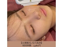 エステティックサロン さらの雰囲気（うぶ毛が減るとメイクノリも◎ニキビ/毛穴/くすみ。美肌効果も◎）